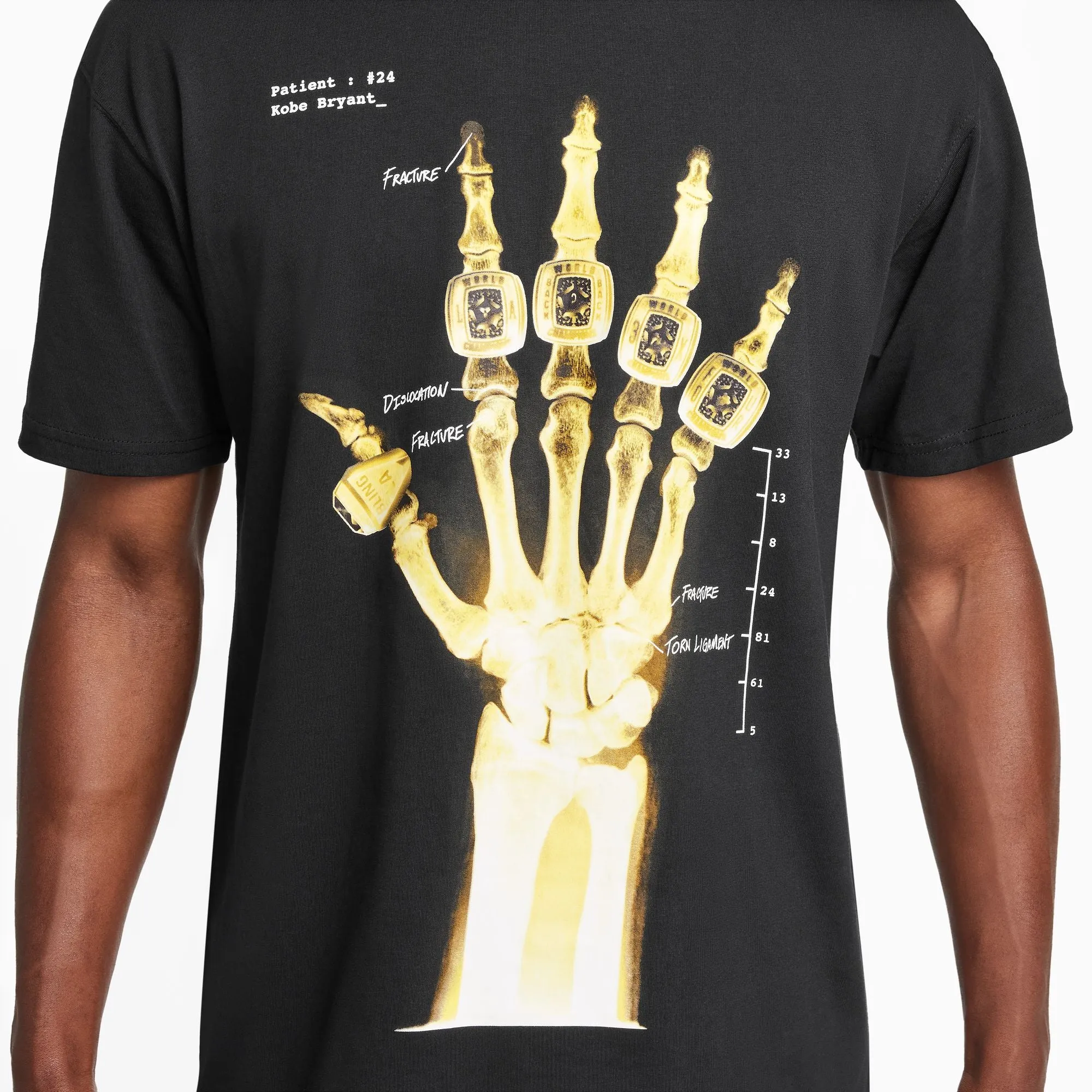 KOBE X-RAY SHIRT "BLACK"